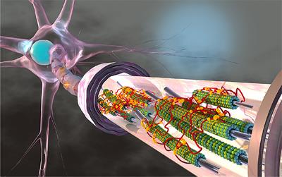 Physical Biology of Axonal Damage